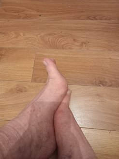 Legs and feet