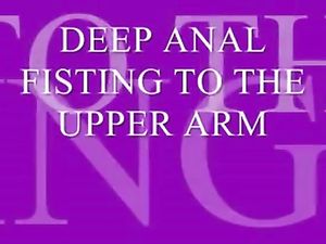DEEP ANAL FISTING TO THE UPPER ARM -v2